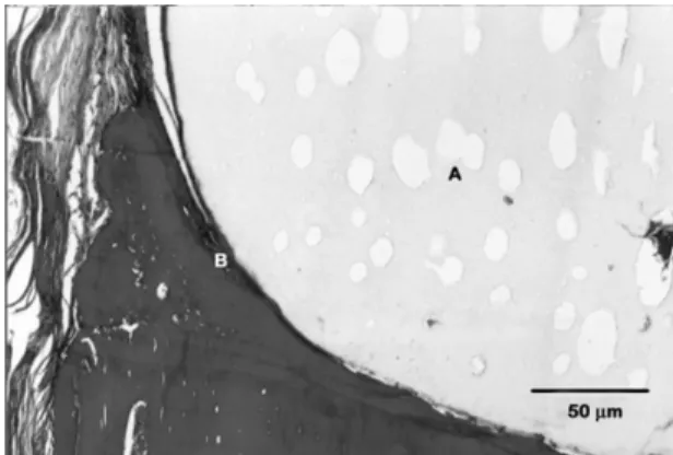 Figure 2. Photomicrograph of the control defect at 30 days  post-surgery. Mesenchymal granulation tissue (GT) with  delicate collagen fibers interlacing anchoring discrete chronic  inflammatory infiltrate (Masson Trichrome).