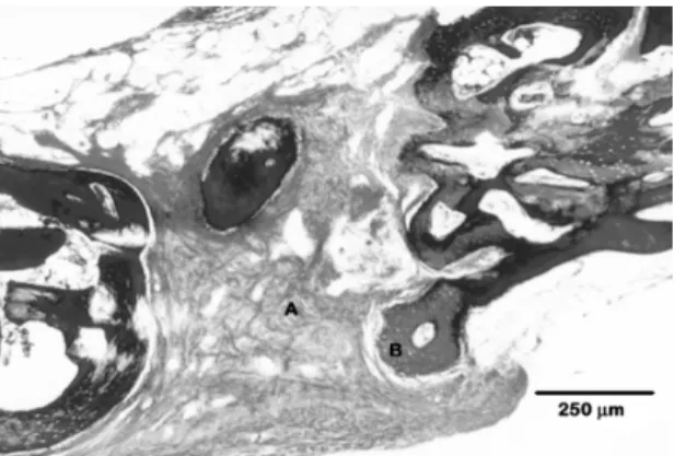 Figure 5. Photomicrograph of the experimental defect area at 90  days post-surgery. Immature non-lamelar bone on the surface (A)  and inside (B) the intercommunicating pores of the polyurethane  resin