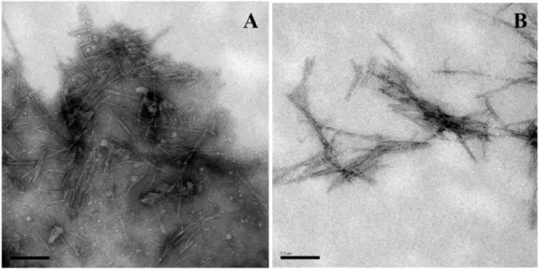 Figure 3. TEM images of the nanocrystals obtained from green coconut fiber cellulose, showing (A) agglomeration of the nanocrystals  and (B) some isolates (Range: 200 nm).
