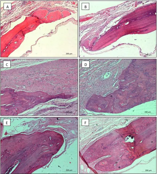 Figure 5B illustrates the central area of   the critical defects  implanted with PLDLA scaffold where, although some regions  show small areas colonized by pre-cultured osteoblasts and  labelled with PKH26, the physical structure of the scaffold  was shown
