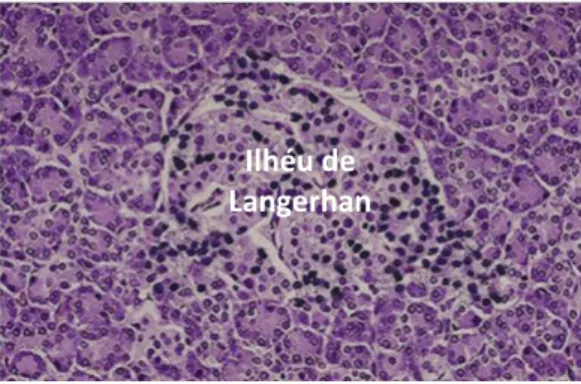 Figura 4. Insulinite: ilhéu pancreático humano infiltrado por linfócitos T e B, macrófagos e células  dendríticas na DMT1 (adaptado) (27)