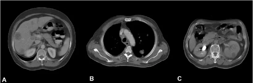 Figure 3 – Computed tomography images used in the simulations.  Figure 3 – Computed tomography images used in the simulations.