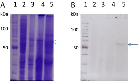Figura  27.  Análise  da  expressão  da  proteína  PolhCyt2Ba  em  células  de  inseto