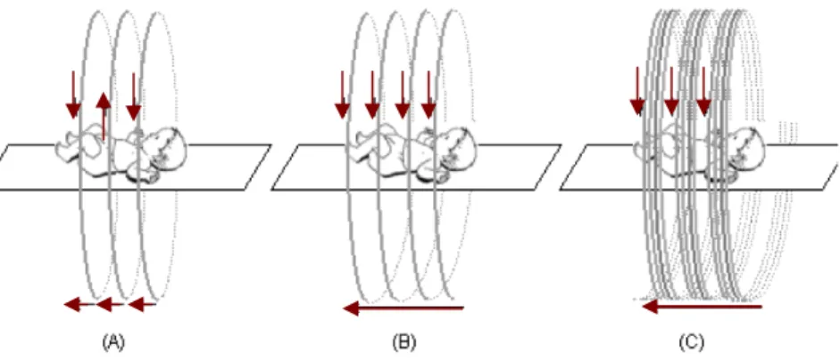 Ilustração 13 – Esquema de 3 tipos de equipamentos de TC (A) Convencional (B) Helicoidal (C) Helicoidal Multicorte