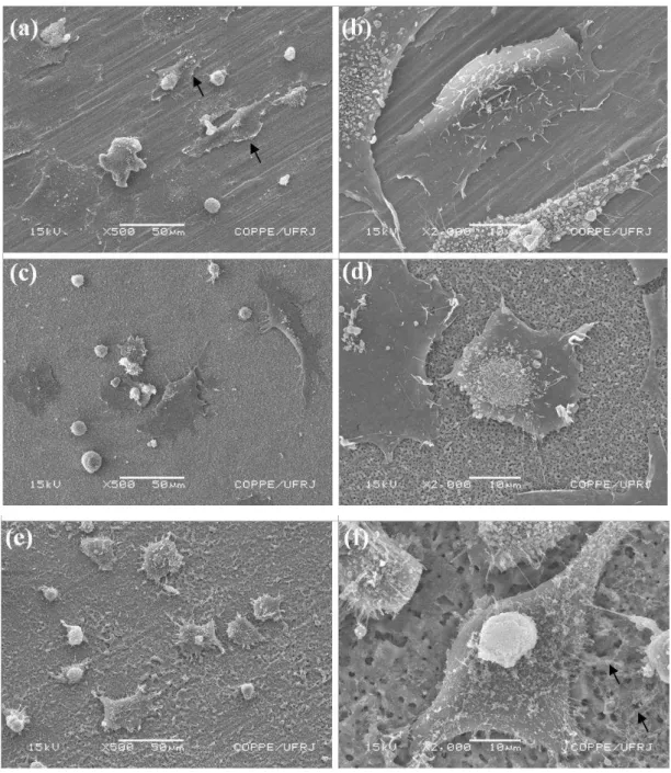 Figure 2: SEM micrographies of osteoblast cells cultured for 4h on (a, b) cp-Ti substrate, and titanium  anodic films produced in: (c, d) 1.0M H 2 SO 4 /150V, and (e, f) 1.0M Na 2 SO 4 /100V
