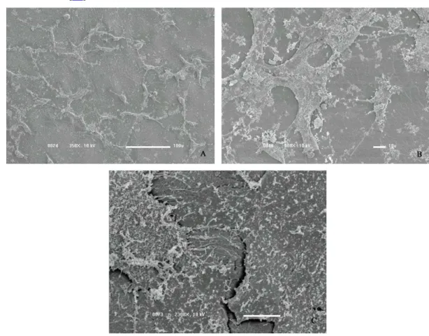 Figura 3: Microscopia eletrônica de varredura (MEV) de células Vero sobre o biomaterial, após 48 horas de  cultivo