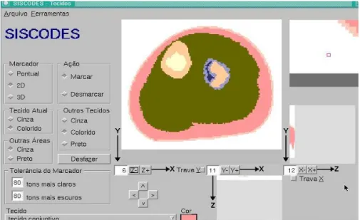 Figura 2: Ilustração do processo de criação do modelo de vóxel utilizando o programa SISCODES  equivalente ao segmento da fíbula com os tecidos em cores