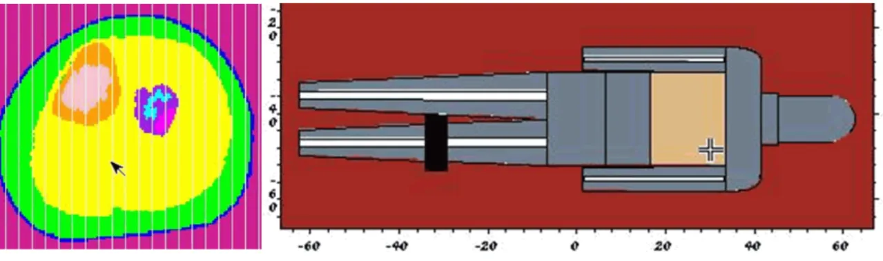 Figura 3: Observa-se uma seção em corte do modelo tridimensional de vóxel (à esquerda), mostrando a  equivalência anatômica; e à direita o corte longitudinal do fantoma analítico com vista da região onde está 