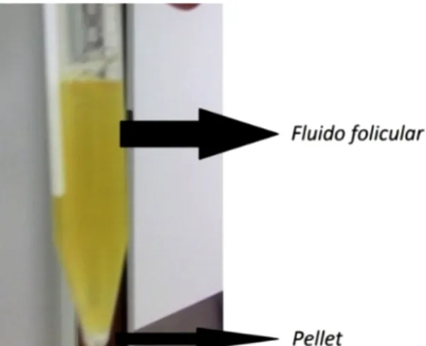 Figura  3:  Tubo  falcon  contendo  fluido  folicular  e  pellet  contendo  os  CCOs  aspirados de folículos entre 2 e 8 mm