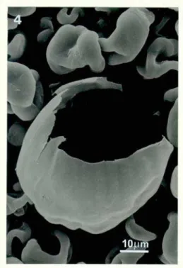 Figure 4: Scanning electron micrograph of the spray-dried powder: hollow sphere showing the broken shell  constituted by pseudoboehmite fibrils