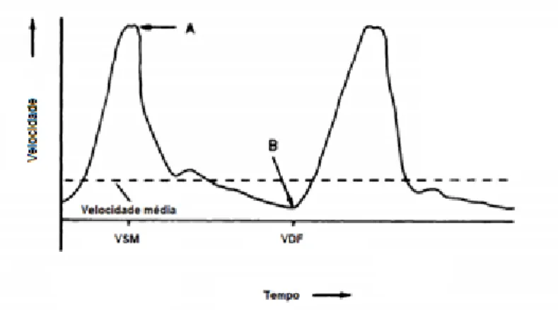 Figura 4- Esquema ilustrativo do traçado espectral Doppler (adaptado de Nelson &amp; Pretorius,  1988)