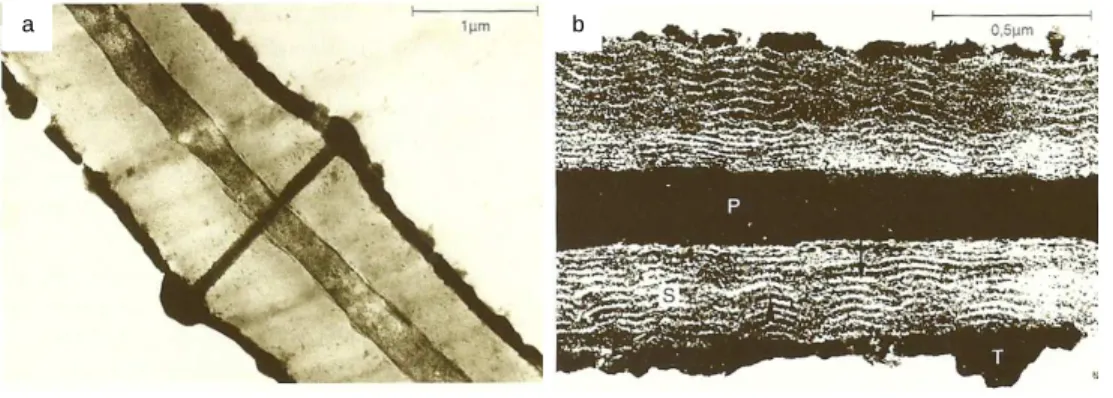 Figura 13 – Microfotografia da parede celular da cortiça em microscopia electrónica de  transmissão