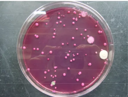 Figura 5. Leveduras e bolores em meio de Agar Dichloran Rose Bengal Chlortetracycline de  uma amostra de Farinheira (original)