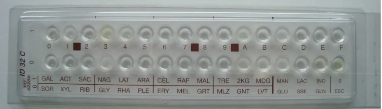 Figura 6.  Sistema API, ID32C – Bio-Merieux, 32200  (original) 