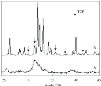 Figure 1 shows SEM micrographs of the obtained com- com-posites revealing that their production was successfully achieved, yielding materials with particles well dispersed within the matrices