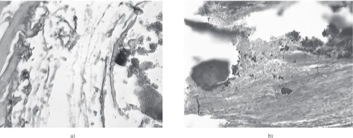 Figura 7. Histological sections of tissue-implant interface after surgical insertion of PMMA/BCP (a) and PMMA/BCP/Sil (b) composite samples 7 days post surgery