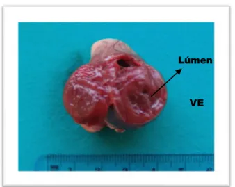 Figura 3 – Corte transversal ao nível do ápex do coração de um gato com CMH  (Cortesia do  Departamento de Anatomia Patológica da FMV-UTL) 