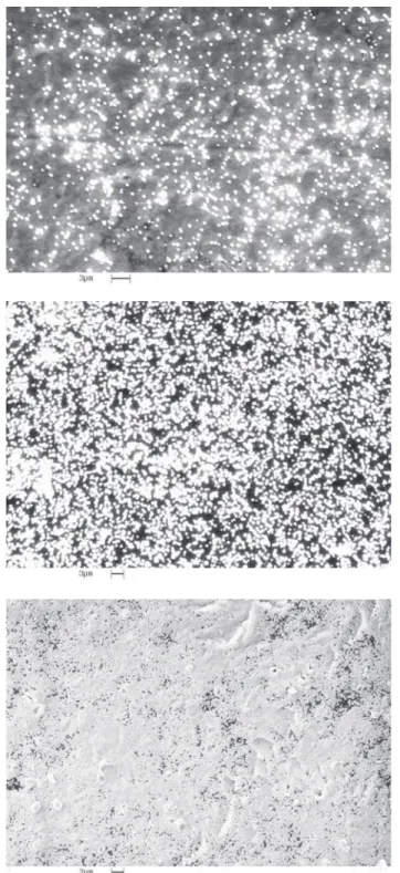 Figure 2. Top view scanning electron micrographs, in the same magnification, for the nucleation on Ti6Al4V substrate using (a) -50; (b) -150; (c) -250 V bias, respectively.