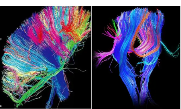 Figura 02 - Tractografia de alta resolução do hemisfério esquerdo do cérebro  Fonte: Google imagens 