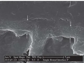 Figure 1. SEM micrograph of resin-dentin interface created by Adper Scotchbond Multi Purpose Plus