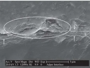 Figure 3. SEM micrograph of resin-dentin interface created by Clearfil Protect Bond. A thin hybrid layer (arrows) and the resin tag formation can be observed.
