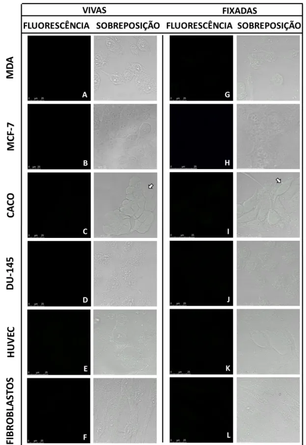Figura 7: Avaliação de autofluorescência em seis tipos celulares tratados com 0,1% do diluente DMSO vivas  (A-F) e fixadas (G-L)
