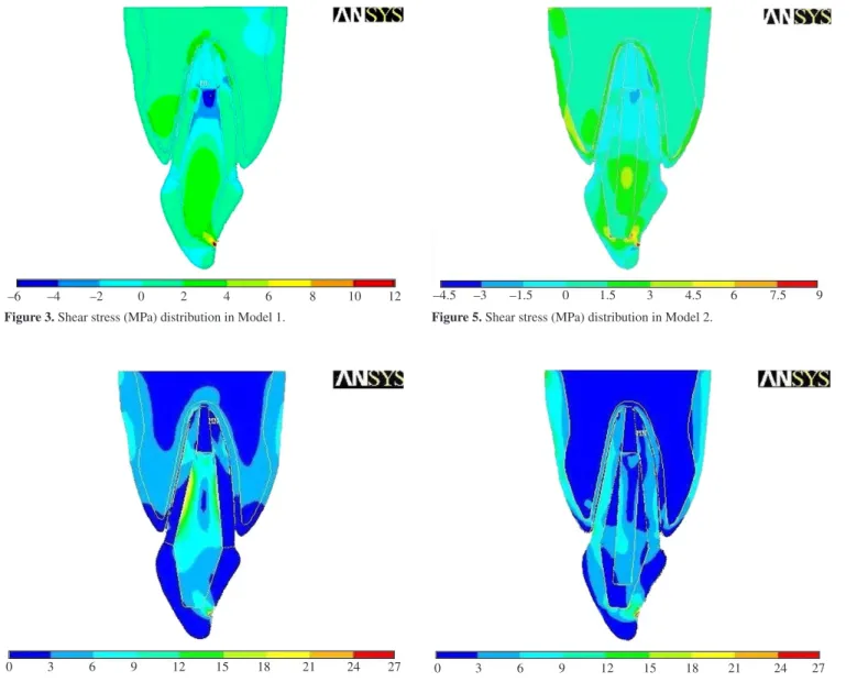 Figure 4. Von Mises equivalent stresses (MPa) in Model 1.