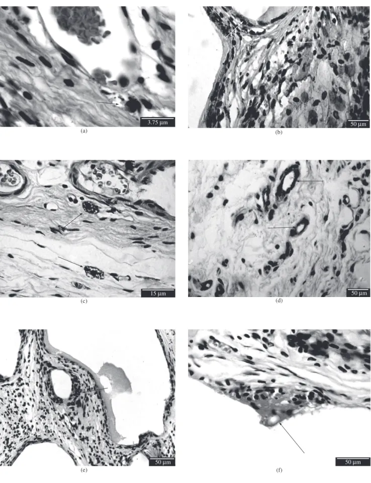 Figure 1. Photomicrographs of the tissue response after 1 month: a) Arrow on polymorphonuclear cell, H&amp;E, control group; b) Arrows on cells immunostained  with anti-lysozyme = macrophages, group HA-1; c) Arrows on mast cells, H&amp;E, control group; d)