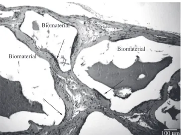 Figure 4. Photomicrograph of anti-Factor VIII immunostained blood vessels  (arrows) in the area of implanted HA-2.