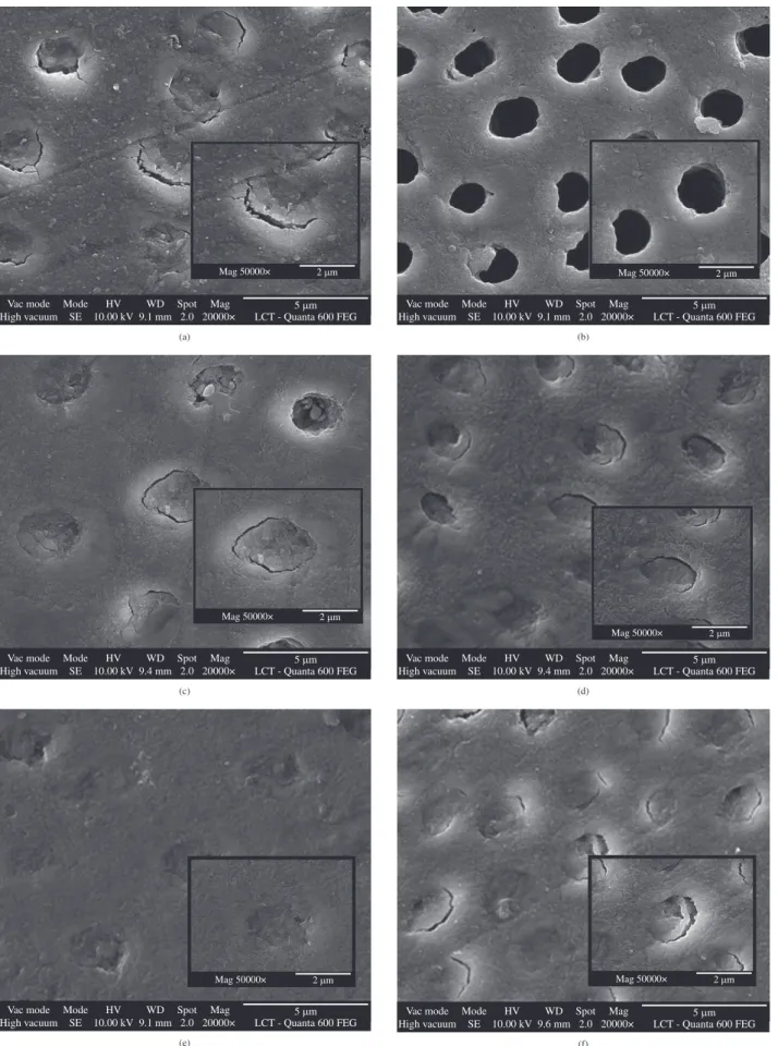 Figure 2. Representative FEG-SEM micrographs (original mag. = 20.000×) of dentin tubular surface: a) Control – untreated dentin; b) dentin surface after  whitening treatment (WT); c) after WT + MI Paste; d) after WT + Relief ACP 30 minutes; e) after WT + R