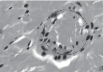 Figure 2. Sample of the heart tissue from a rat injected with Ti6Al4V alloy  particles showing an epithelioid granuloma, 400×.