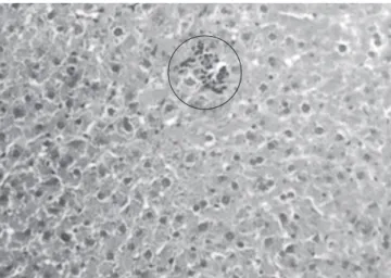 Figure 6. EDS plot analysis showing a peak of yttrium in the sample isolated  from the liver of a rat injected with stainless steel 316L particles.