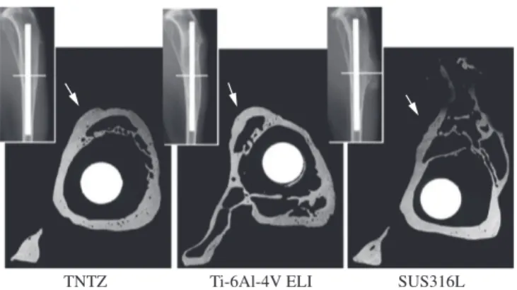 Figure 1. Contact microradiographies of a cross section of tibia after in vivo  testing 11 .