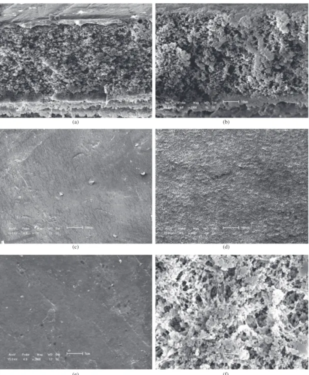 Figure 2. SEM micrographs of PVDF membranes: cross section (1000×) of A membrane (a) and B membrane (d); surface (100×) of A  membrane (b) and B membrane (e); surface (2000×) of A membrane (c) and B membrane (f).