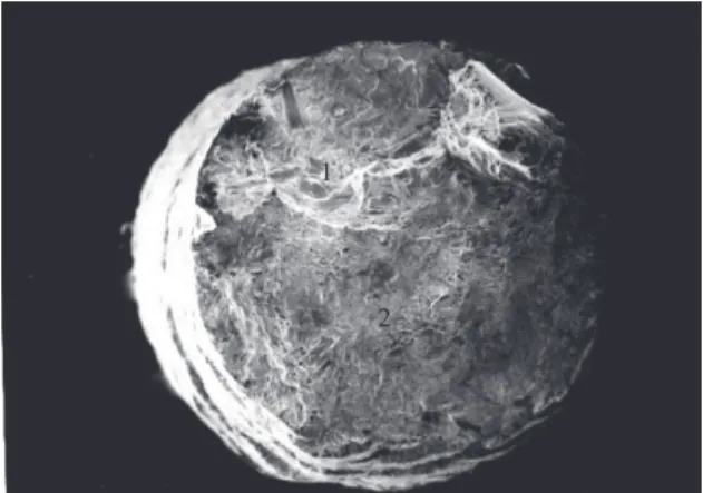 Figure 6. SEM micrograph of fracture surface of laser-welded cpTi  sample at 1000X magnification