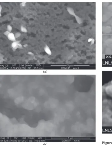 Figure 6a shows the XRD of hydroxyapatite gel calcined  at 500 °C for 4 hours. This sample shows the major peak of  hydroxyapatite in 31.6° that corresponds to hydroxyapatite  (211) plane 30 , also between 30° and 31° there is a peak with  low intensity of