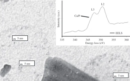 Figure 5. Results of HA gel before calcination obtained by transmission electron microscope