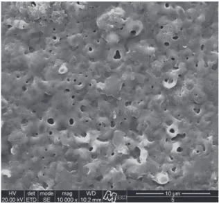 Figure 2. SEM image of the oxide film obtained by the MAO  process.