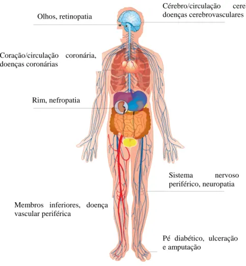 Fig.  3.1  -  Complicações  mais  significativas  associadas  à  diabetes  e  órgãos  mais  afetados  por  esta  doença