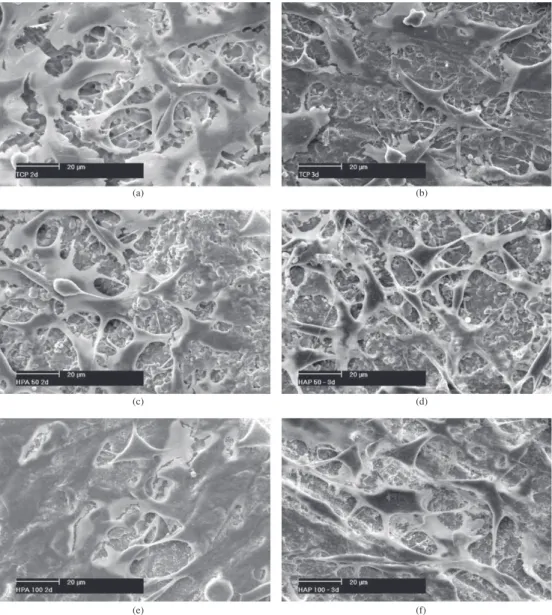 Figure 7. Scanning electron micrographs (in detail) of FMM1 cells grown on sintered HAp/TCP ceramic substrates after 2 and 3 days  cell culture