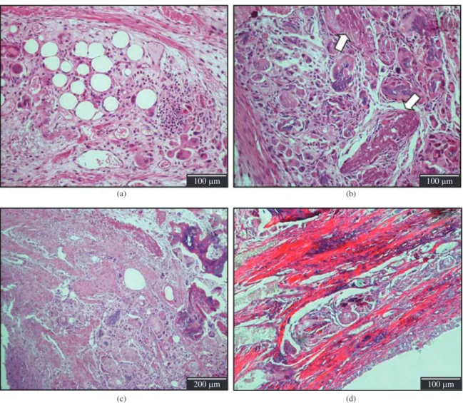 Figure 3. Histological analysis of control lesions (untreated) after four weeks. (a), (b) and (c): HE staining; (d) Picrosirius red staining