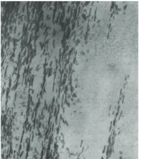 Figure 28. Micrographs of longitudinal sections through stained  Kevlar 29 [ 60 ] .