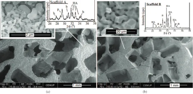 Figure 2. (a) Pores on scaffold A calcined at 725 °C. In the details of “Figure a” surface morphology at higher magnification may be seen  and the XRD analysis (b: beta-TCP; p: pyrophosphate; HA: hydroxyapatite)
