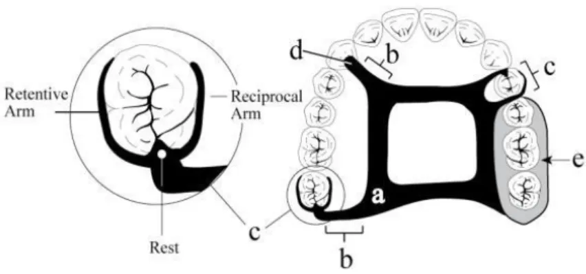 Figura 1: Constituintes de uma prótese parcial removível (Loney, 2011): 