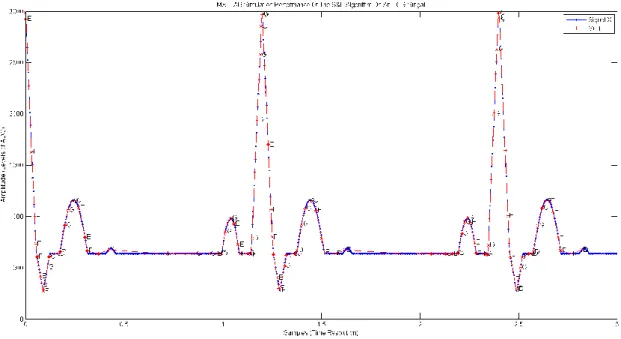 Figure 2.14. Graphical representation of the MATLAB simulation performance of the S&amp;L algorithm on  an ECG Signal