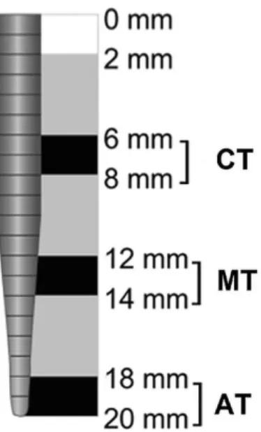 Figure 2. Schematic representation of the nº 1 White Post DC  iberglass post sections, where “CT” is the Cervical Third, “MT” 