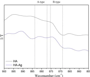 Figure 5. X-ray diffraction pattern of the HA sample after calcination at 1000 °C/2 h
