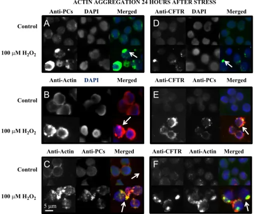 Fig. 3. Actin aggregates in aggresomes. For each panel upper and bottom images are from control and 100 m M H 2 O 2 , respectively, and are taken after 24 h of exposure to hydrogen peroxide