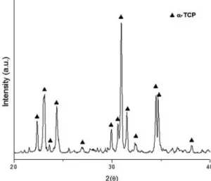 Figure 2: XRD pattern for the powder synthesized through wet  precipitation method and charred at 1400°C for an hour.