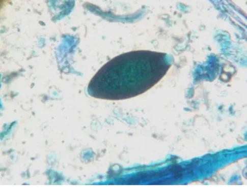 Figura 1: Ovo de Trichuris vulpis, encontrado nas fezes de cão, visto ao microscópio. 